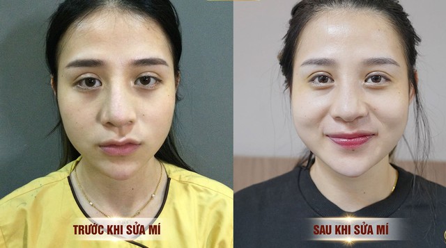 “Công cuộc giải cứu” và làm đẹp lại những đôi mắt bị hỏng do phẫu thuật - Ảnh 4.