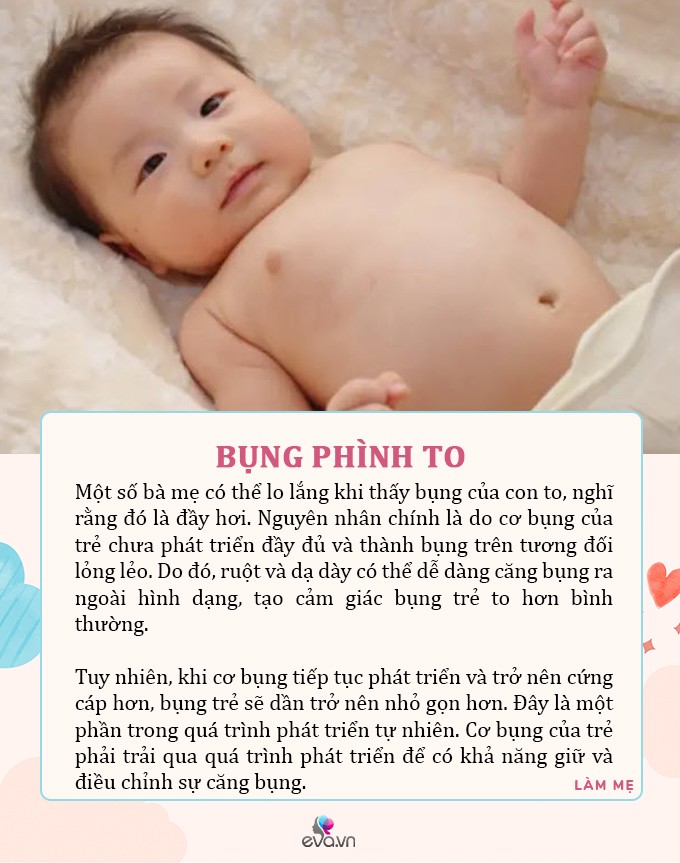 Trẻ có 6 đặc điểm “bất thường” sau khi sinh, ai lần đầu làm bố mẹ nên biết - 6