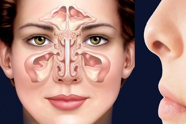 Viêm xoang trán là tình trạng niêm mạc xoang trán bị viêm, gây bít tắc lỗ thông xoang, gây tình trạng tích tụ chất lỏng hoặc chất nhầy bên trong lòng xoang. Viêm xoang trán là tình trạng niêm mạc xoang trán bị viêm, gây bít tắc lỗ thông xoang, gây tình trạng tích tụ chất lỏng hoặc chất nhầy bên trong lòng xoang.