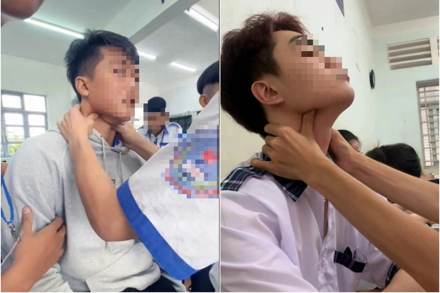 Nguy cơ tử vong từ 'bắt pen' - Ảnh 1.