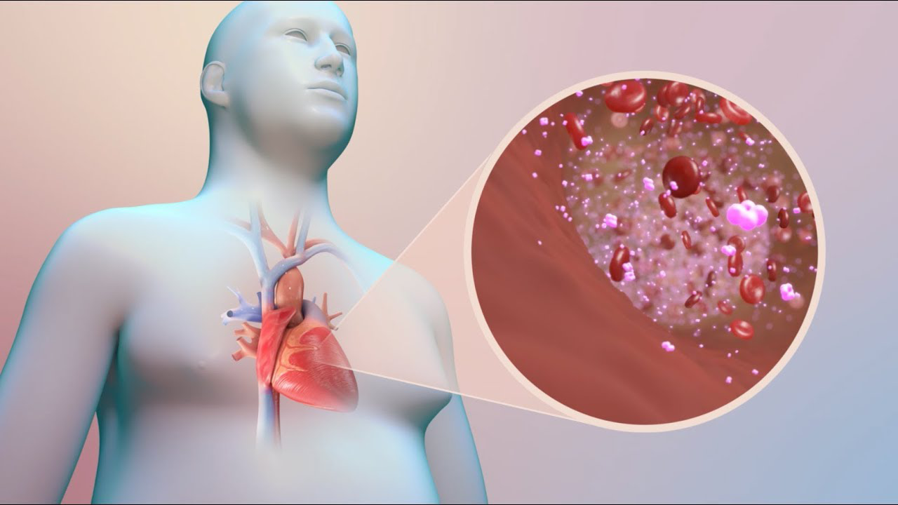 'Thủ phạm' khiến người đái tháo đường tăng nguy cơ mắc bệnh tim mạch- Ảnh 1. 'Thủ phạm' khiến người đái tháo đường tăng nguy cơ mắc bệnh tim mạch- Ảnh 1.