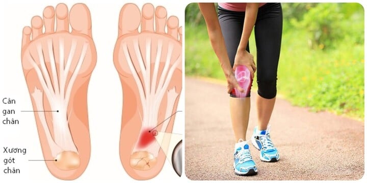 Đi bộ quá nhiều gây ra nhiều tác hại với sức khoẻ