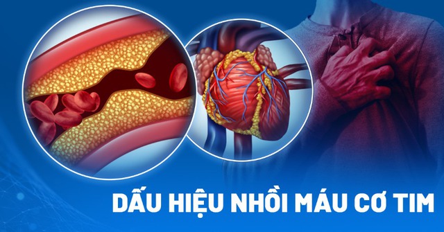 Biến chứng đáng sợ của căn bệnh ông Hoàng Nam Tiến tiết lộ mắc phải trước đó nguy hiểm ra sao? - Ảnh 3.