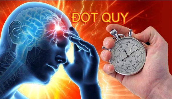 Tin vui cho người bệnh đột quỵ: Thêm cơ hội hồi phục cho người bị đột quỵ 'quá giai đoạn vàng' - Ảnh 2.