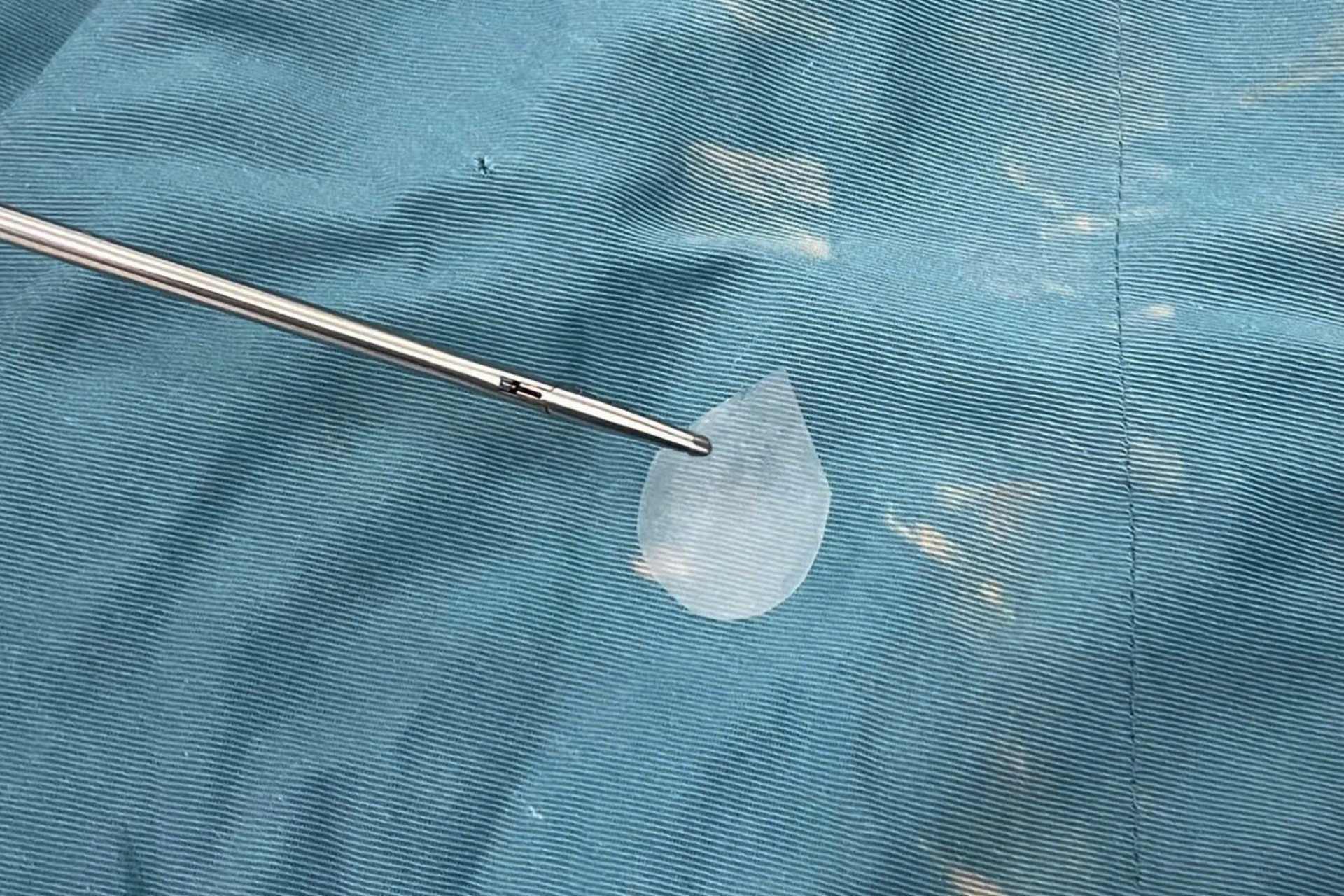 Ăn bánh sinh nhật, bé trai 11 tuổi suýt nguy hiểm tính mạng vì dị vật khó tin - Ảnh 2.