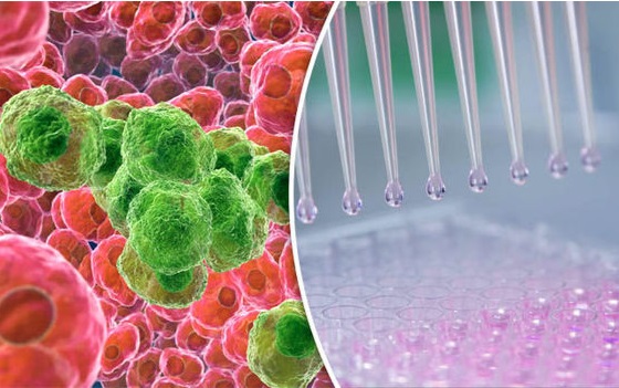 3 bước quan trọng trong khám tầm soát ung thư, ai cũng nên biết - Ảnh 2. 3 bước quan trọng trong khám tầm soát ung thư, ai cũng nên biết - Ảnh 2.