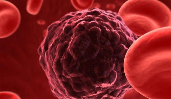 4 thực phẩm có đặc tính ngăn ngừa phát triển của tế bào ung thư, người Việt nên ăn nhiều hơn - Ảnh 2.