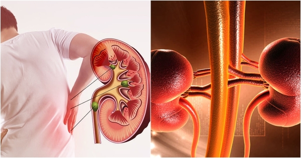 Suy thận tiến triển rất nhanh: 4 dấu hiệu cảnh báo cho người tiểu đường - Ảnh 2.