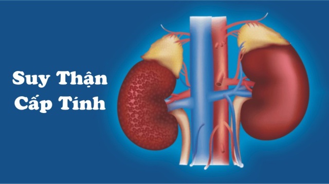 8 dấu hiệu bệnh suy thận, người Việt cần biết để phòng bệnh từ sớm - Ảnh 3. 8 dấu hiệu bệnh suy thận, người Việt cần biết để phòng bệnh từ sớm - Ảnh 3.