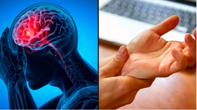 Dấu hiệu nguy hiểm nhất của đột quỵ không phải tê tay chân, nhiều người Việt hiểu lầm mà không biết - Ảnh 1. Dấu hiệu nguy hiểm nhất của đột quỵ không phải tê tay chân, nhiều người Việt hiểu lầm mà không biết - Ảnh 1.