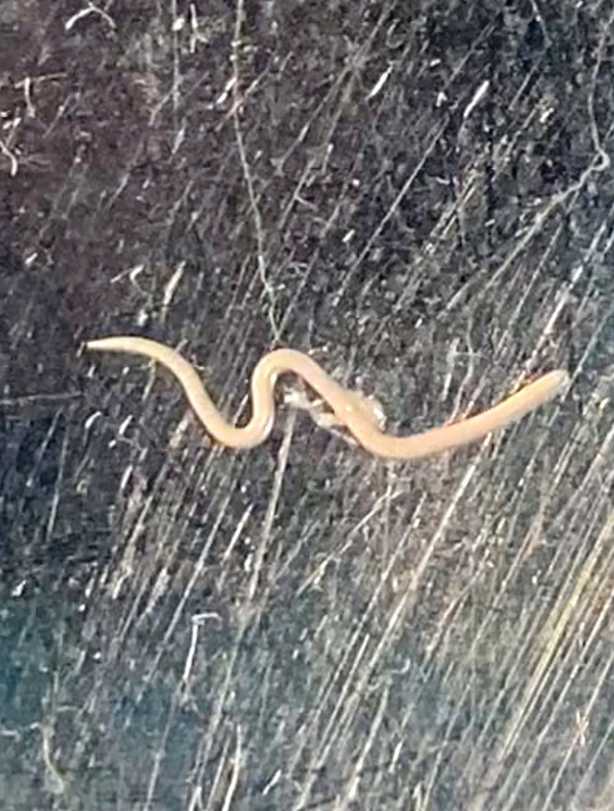 Gắp giun lươn sống ký sinh trong mắt bệnh nhân , cảnh báo nguy cơ nhiễm trùng - Ảnh 2.