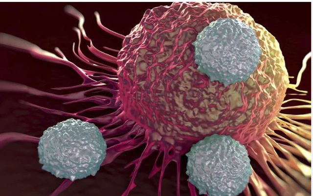 Thanh niên 29 tuổi phát hiện ung thư hiếm gặp từ dấu hiệu nhiều người Việt bỏ qua - Ảnh 2.