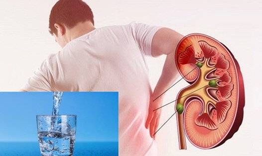 Thói quen uống nước làm tăng nguy cơ suy thận, nhiều người Việt đang mắc mà không biết - Ảnh 1. Thói quen uống nước làm tăng nguy cơ suy thận, nhiều người Việt đang mắc mà không biết - Ảnh 1.