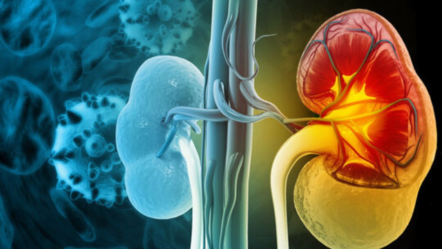 Dấu hiệu cảnh báo suy thận: Đi bộ thấy biểu hiện này cần đặc biệt lưu ý - Ảnh 2.