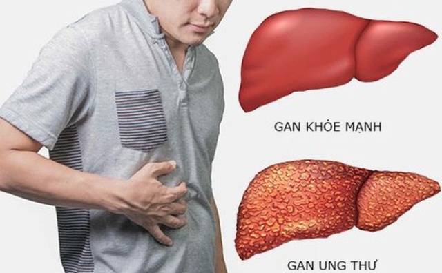 Người đàn ông 49 tuổi phát hiện ung thư gan, thừa nhận 1 thói quen trước khi ngủ nhiều người Việt mắc phải - Ảnh 2.