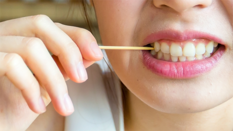 Những điều cần lưu ý khi dùng chỉ nha khoa để bảo vệ sức khỏe răng miệng - Ảnh 2.