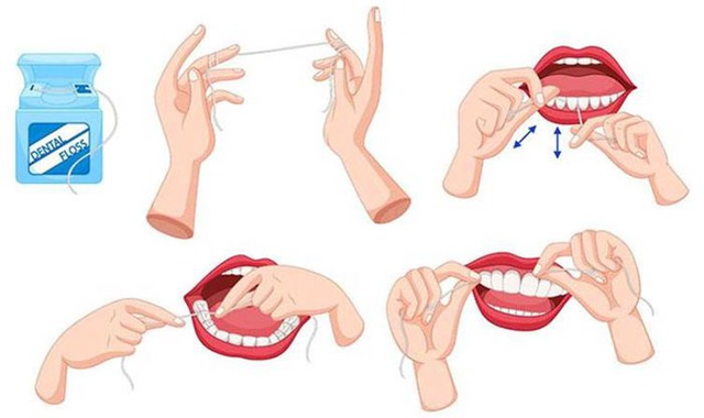 Những điều cần lưu ý khi dùng chỉ nha khoa để bảo vệ sức khỏe răng miệng - Ảnh 3.