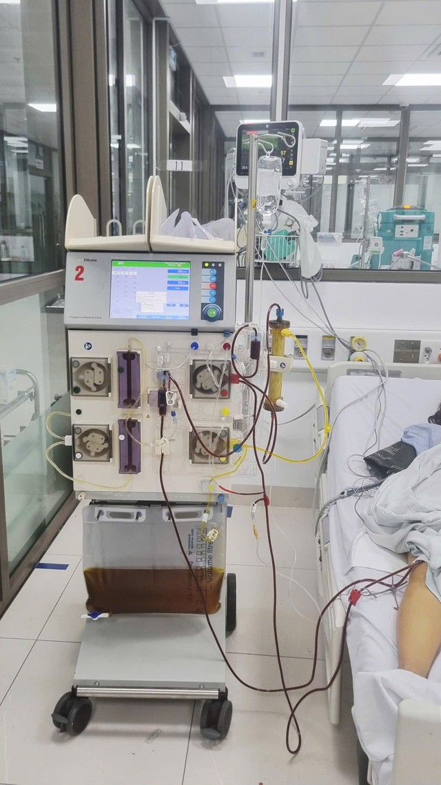 Suy gan cấp, ngộ độc nặng dịp nghỉ lễ: Cảnh báo nguy cơ từ những thói quen nhiều người Việt mắc phải - Ảnh 2.